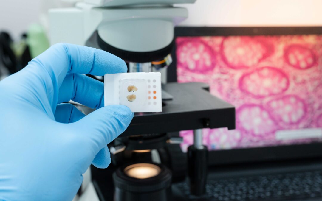 Scientist wear blue glove holding parafin human tissue block and out of focus microscope and computer monitor show glandular image