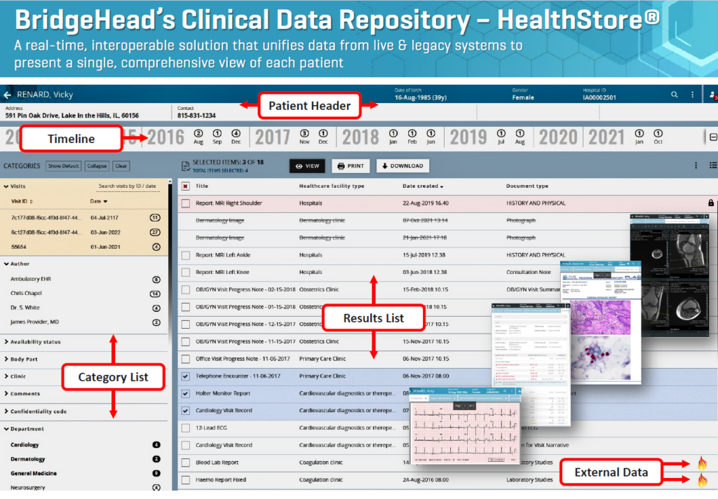 Image of BridgeHead Clinical Data Repository 